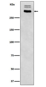 Anti-Thyroglobulin Rabbit Monoclonal Antibody Boster Bio