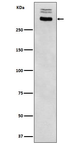 Anti-Thyroglobulin Rabbit Monoclonal Antibody Boster Bio