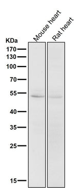 Anti-CD47 Rabbit Monoclonal Antibody Boster Bio