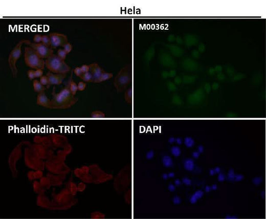 Anti-TMS1 PYCARD Rabbit Monoclonal Antibody Boster Bio