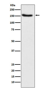 Anti-Hamartin Rabbit Monoclonal Antibody Boster Bio