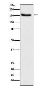 Anti-Hamartin Rabbit Monoclonal Antibody Boster Bio