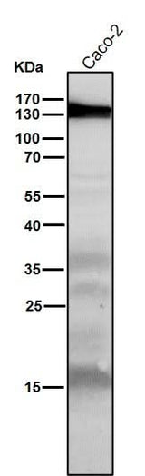Anti-iNOS NOS2 Rabbit Monoclonal Antibody Boster Bio