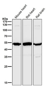 Anti-Angiopoietin 2 Rabbit Monoclonal Antibody Boster Bio