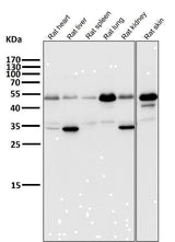 Anti-ATF4 Rabbit Monoclonal Antibody Boster Bio