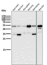 Anti-ATF4 Rabbit Monoclonal Antibody Boster Bio