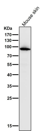Anti-Myeloperoxidase Rabbit Monoclonal Antibody Boster Bio