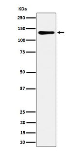 Anti-MCM2 Rabbit Monoclonal Antibody Boster Bio