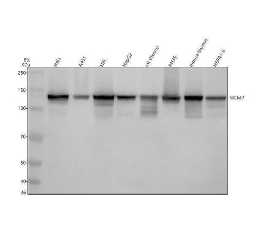 Anti-MCM2 Rabbit Monoclonal Antibody Boster Bio