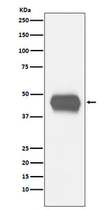 Anti-CD1a Rabbit Monoclonal Antibody Boster Bio