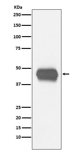 Anti-CD1a Rabbit Monoclonal Antibody Boster Bio
