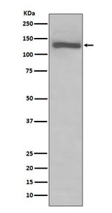 Anti-TLR7 Rabbit Monoclonal Antibody Boster Bio