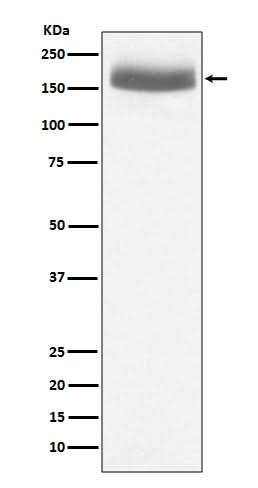 Anti-EGF Rabbit Monoclonal Antibody Boster Bio