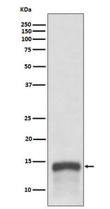 Anti-S100A9 Rabbit Monoclonal Antibody Boster Bio