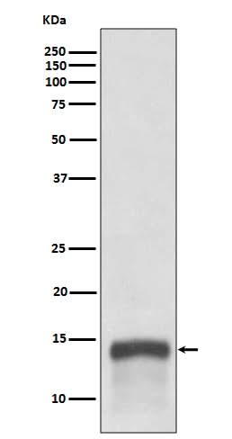 Anti-S100A9 Rabbit Monoclonal Antibody Boster Bio