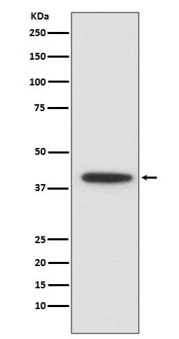 Anti-CEBP alpha Rabbit Monoclonal Antibody Boster Bio