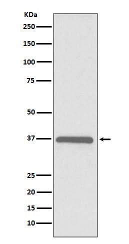 Anti-ERCC1 Rabbit Monoclonal Antibody Boster Bio
