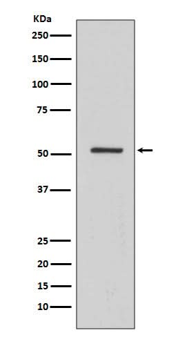 Anti-HNF-4-alpha Rabbit Monoclonal Antibody Boster Bio