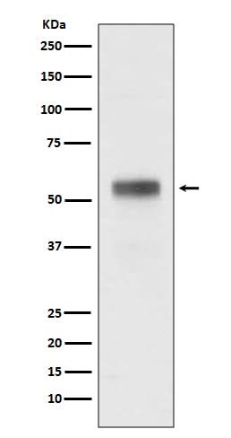 Anti-Retinoic Acid Receptor alpha RARA Rabbit Monoclonal Antibody Boster Bio