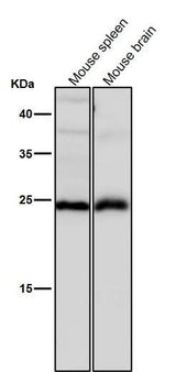 Anti-Interferon gamma IFNG Rabbit Monoclonal Antibody Boster Bio