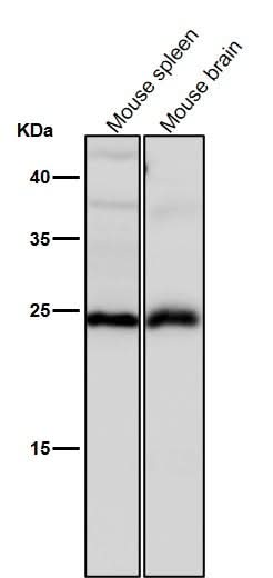 Anti-Interferon gamma IFNG Rabbit Monoclonal Antibody Boster Bio