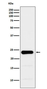 Anti-GST3 / GSTP1 Monoclonal Antibody Boster Bio