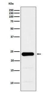 Anti-GST3 / GSTP1 Monoclonal Antibody Boster Bio