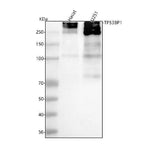 Anti-53BP1 TP53BP1 Rabbit Monoclonal Antibody Boster Bio