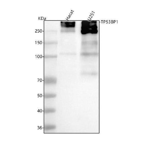 Anti-53BP1 TP53BP1 Rabbit Monoclonal Antibody Boster Bio