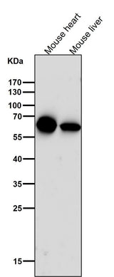 Anti-Cytokeratin 5 KRT5 Rabbit Monoclonal Antibody Boster Bio