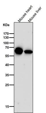 Anti-Cytokeratin 5 KRT5 Rabbit Monoclonal Antibody Boster Bio
