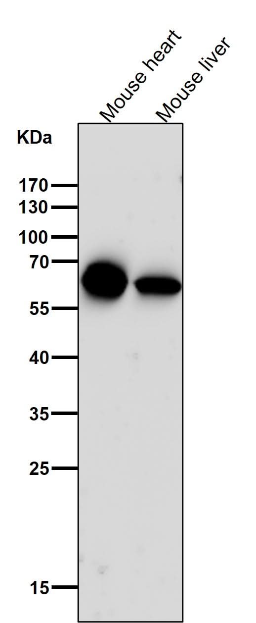 Anti-Cytokeratin 5 KRT5 Rabbit Monoclonal Antibody Boster Bio