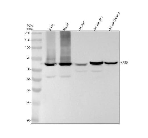 Anti-Cytokeratin 5 (C-term) KRT5 Rabbit Monoclonal Antibody Boster Bio