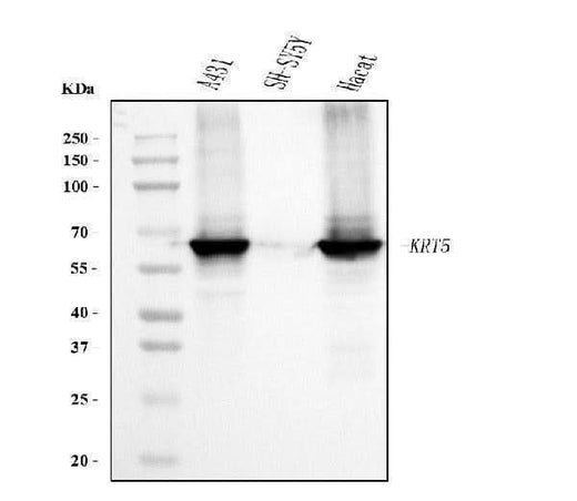 Anti-Cytokeratin 5 Antibody Picoband® (monoclonal, 5D3F7 Boster Bio