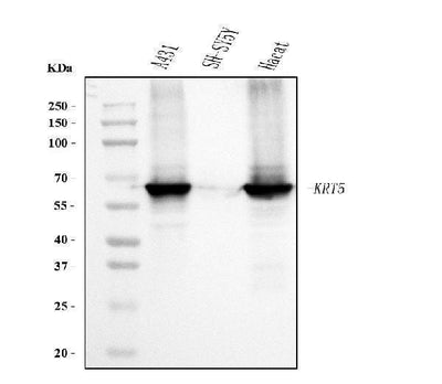 Anti-Cytokeratin 5 Antibody Picoband® (monoclonal, 5D3F7 Boster Bio