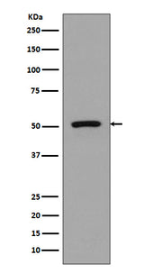 Anti-FLI1 Rabbit Monoclonal Antibody Boster Bio