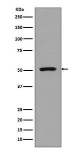 Anti-FLI1 Rabbit Monoclonal Antibody Boster Bio