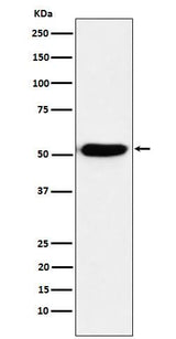Anti-IRF4 Rabbit Monoclonal Antibody Boster Bio