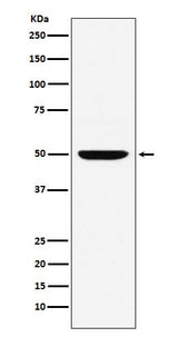 Anti-MUM1 Monoclonal Antibody Boster Bio