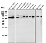 Anti-NOX4 Rabbit Monoclonal Antibody Boster Bio