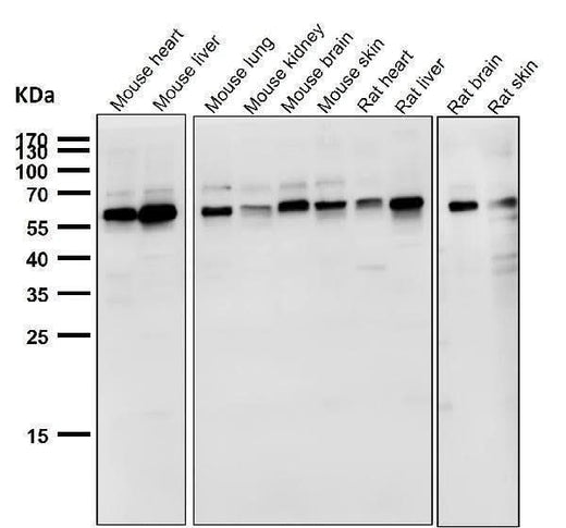 Anti-NOX4 Rabbit Monoclonal Antibody Boster Bio