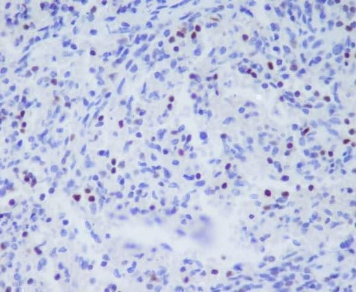 Anti-TBX21 Rabbit Monoclonal Antibody Boster Bio