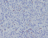 Anti-TBX21 Rabbit Monoclonal Antibody Boster Bio