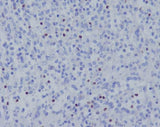 Anti-TBX21 Rabbit Monoclonal Antibody Boster Bio