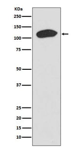 Anti-KAP1 TRIM28 Rabbit Monoclonal Antibody Boster Bio