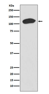 Anti-KAP1 TRIM28 Rabbit Monoclonal Antibody Boster Bio