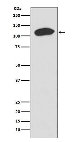 Anti-KAP1 TRIM28 Rabbit Monoclonal Antibody Boster Bio