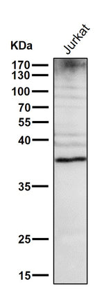 Anti-DR5 Rabbit Monoclonal Antibody Boster Bio