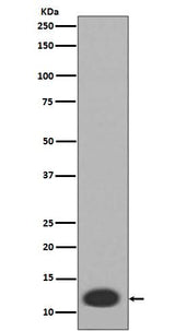 Anti-MRP8 S100A8 Rabbit Monoclonal Antibody Boster Bio