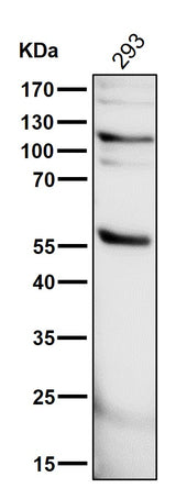Anti-PHD2 / prolyl hydroxylase Monoclonal Antibody Boster Bio